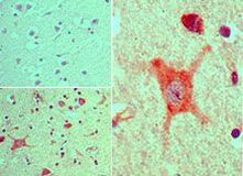 PER2 Antibody in Immunohistochemistry (Paraffin) (IHC (P))