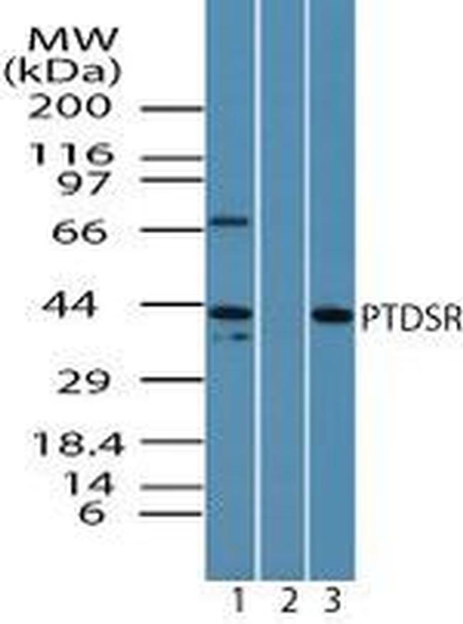 JMJD6 Antibody in Western Blot (WB)