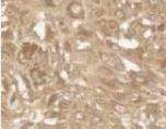 PUMA alpha Antibody in Immunohistochemistry (IHC)