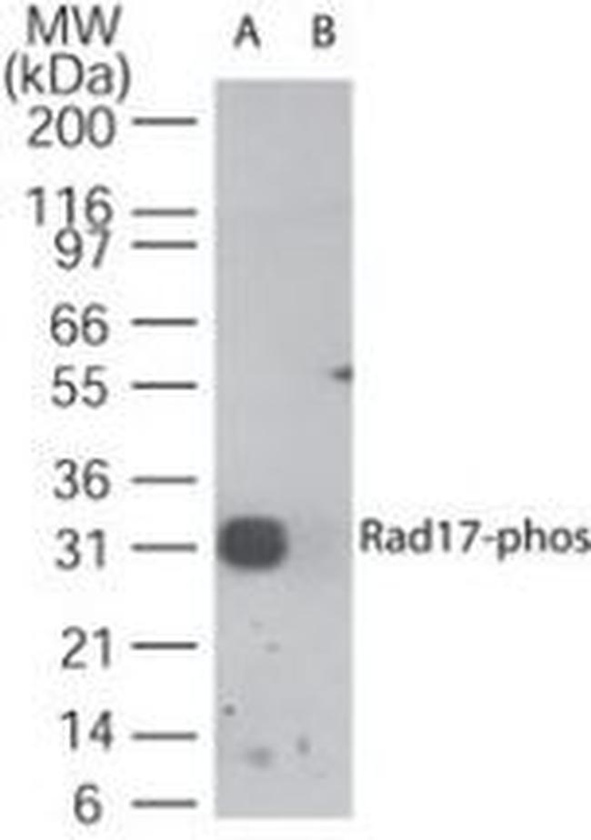 Phospho-RAD17 (Ser647) Antibody in Western Blot (WB)