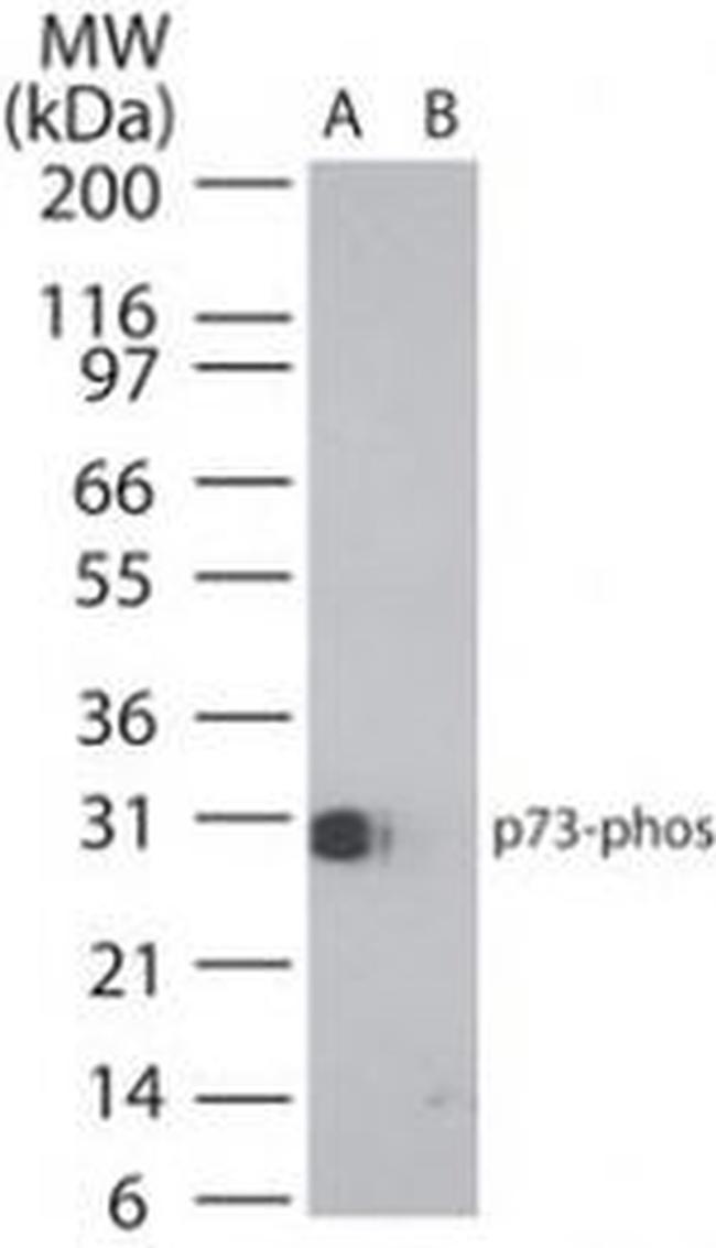 Phospho-p73 (Tyr99) Antibody in Western Blot (WB)