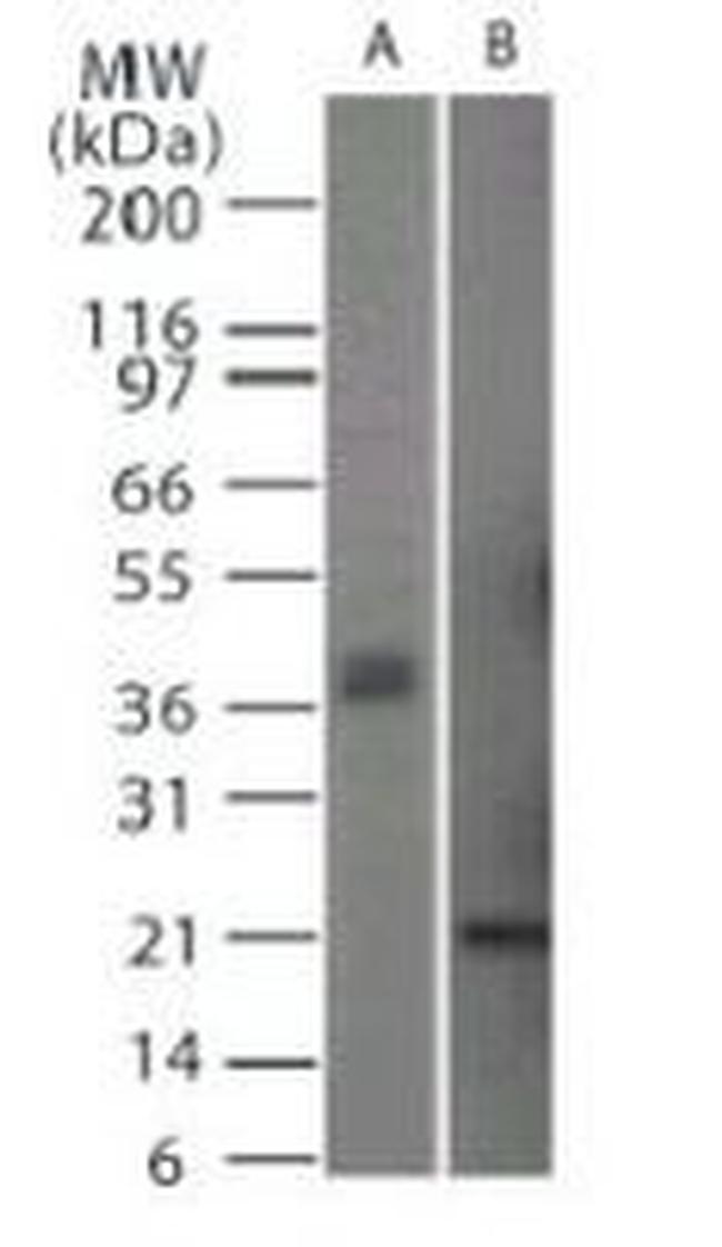 CD254 (RANK Ligand) Antibody in Western Blot (WB)