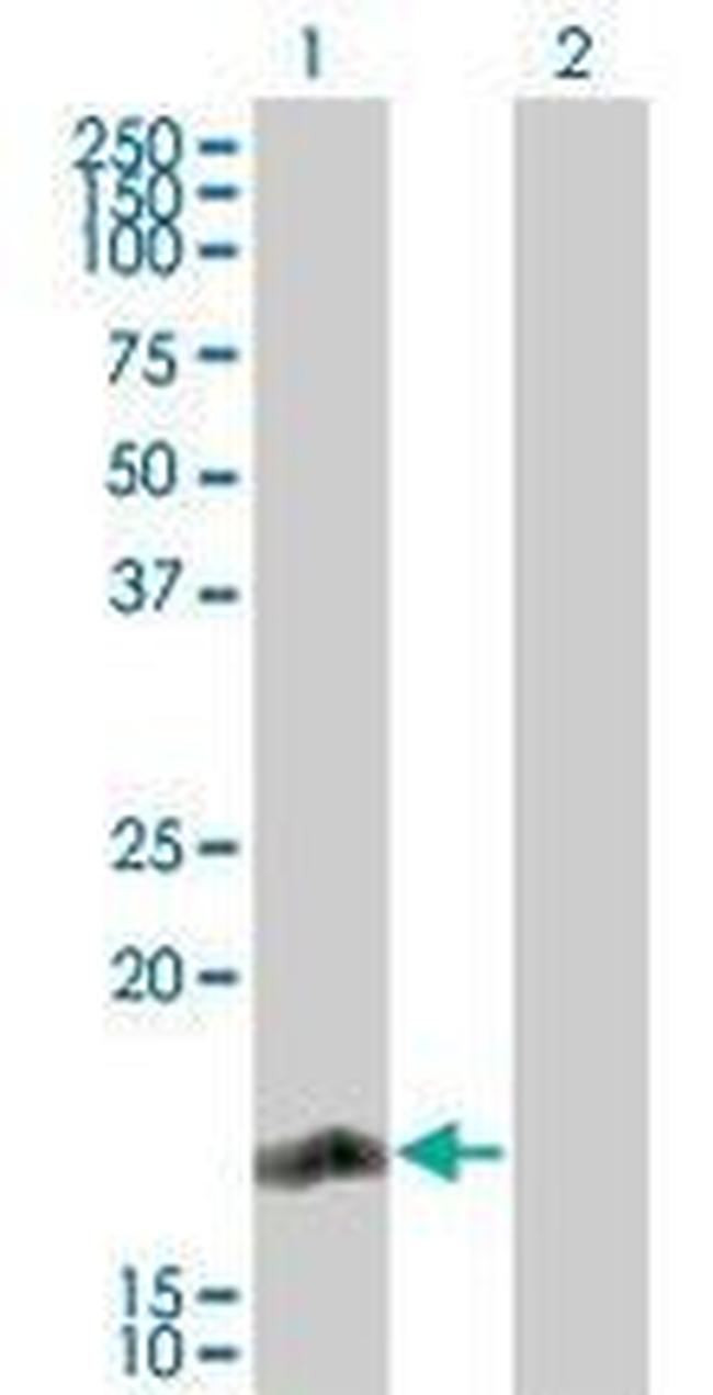 RGS13 Antibody in Western Blot (WB)