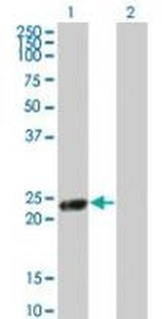 RGS5 Antibody in Western Blot (WB)