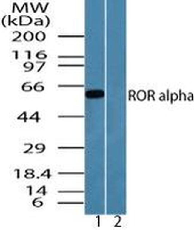 RORA Antibody in Western Blot (WB)