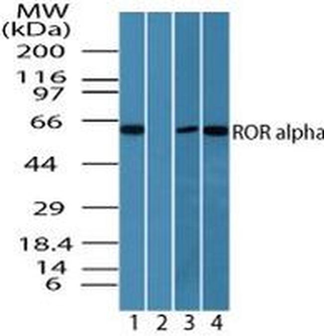 RORA Antibody in Western Blot (WB)