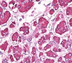 REG1A Antibody in Immunohistochemistry (Paraffin) (IHC (P))