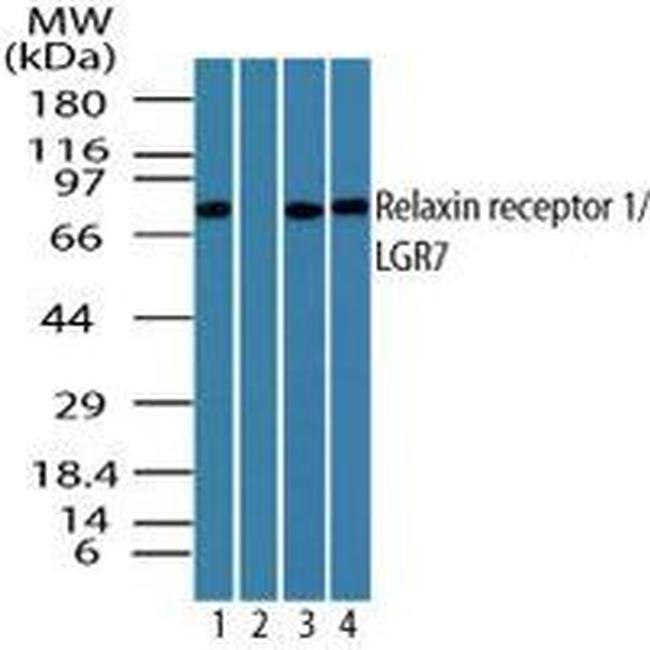 LGR7 Antibody in Western Blot (WB)