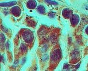 Rhox2 Antibody in Immunohistochemistry (Paraffin) (IHC (P))