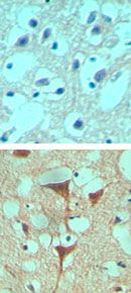 SMO Antibody in Immunohistochemistry (Paraffin) (IHC (P))