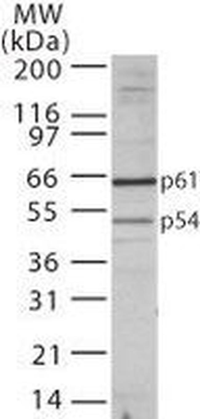 TBLR1 Antibody in Western Blot (WB)