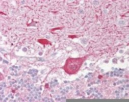 TIGAR Antibody in Immunohistochemistry (IHC)