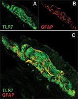 TLR7 Antibody in Immunocytochemistry (ICC/IF)