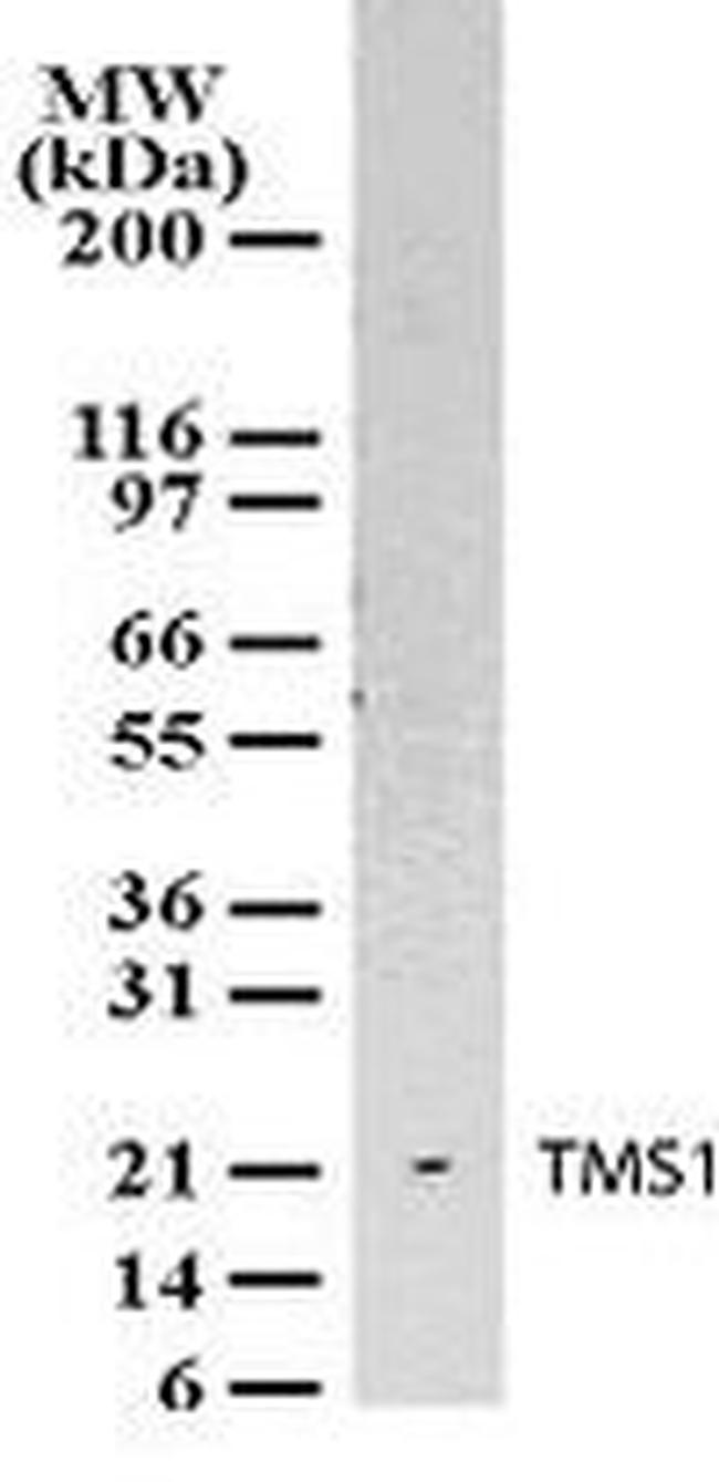 PYCARD Antibody in Western Blot (WB)