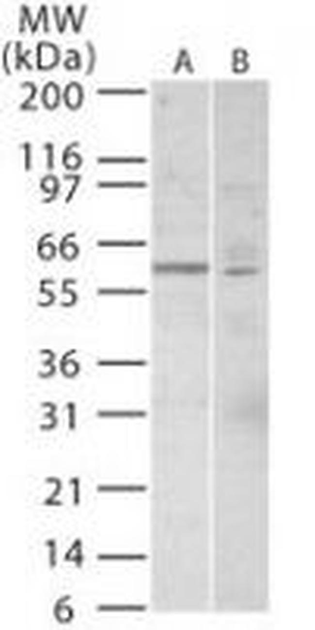 TRF1 Antibody in Western Blot (WB)