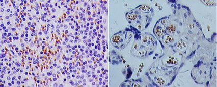 TSLP Antibody in Immunohistochemistry (Paraffin) (IHC (P))