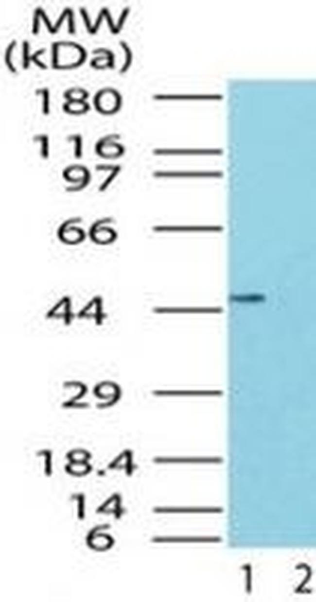 TRBP Antibody in Western Blot (WB)