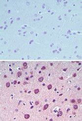UCP4 Antibody in Immunohistochemistry (Paraffin) (IHC (P))