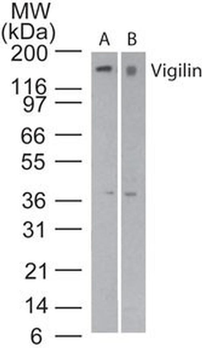 HDLBP Antibody in Western Blot (WB)