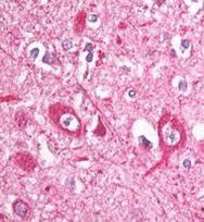 eIF3b Antibody in Immunohistochemistry (Paraffin) (IHC (P))
