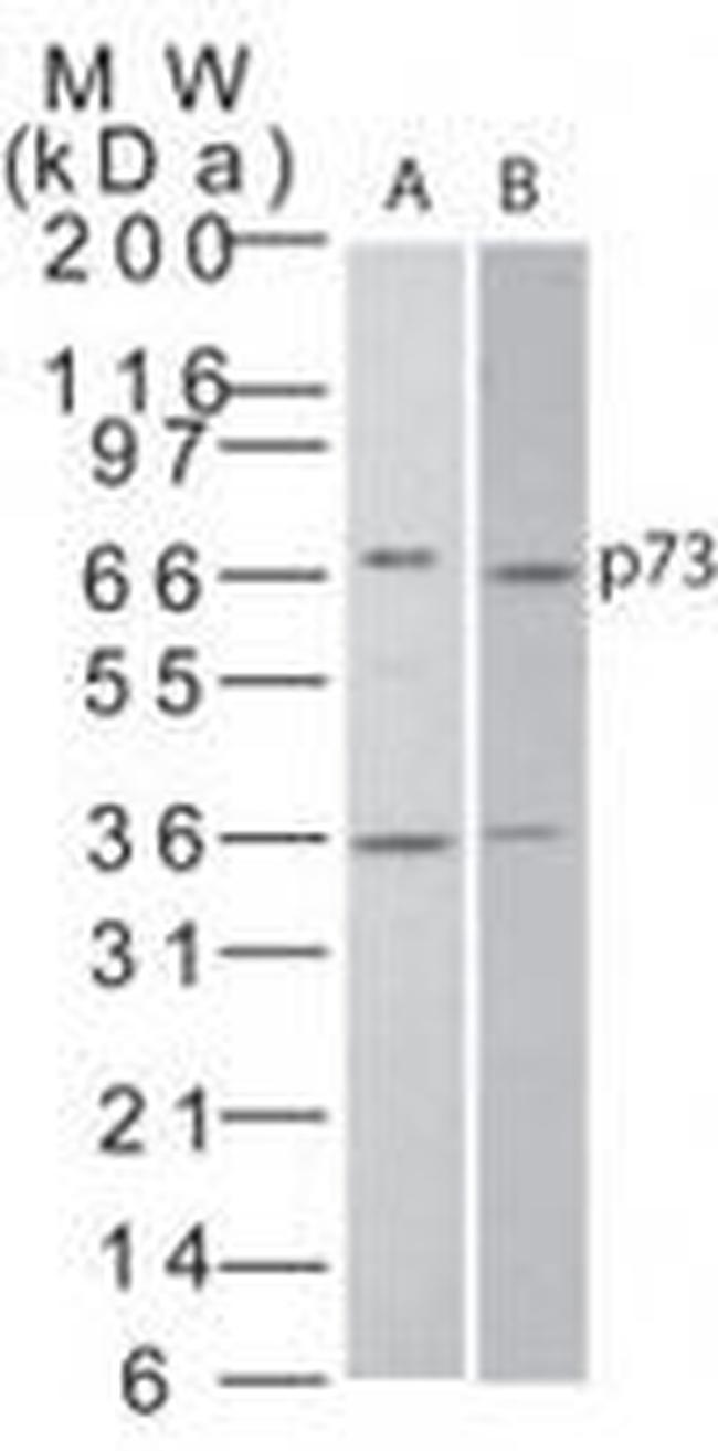 p73 Antibody in Western Blot (WB)