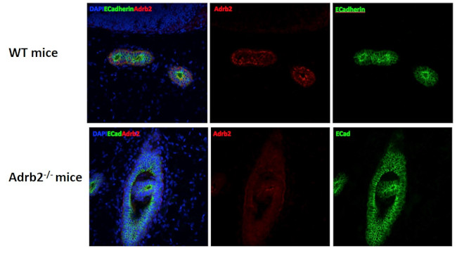 beta-2 Adrenergic Receptor Antibody in Immunocytochemistry (ICC/IF)