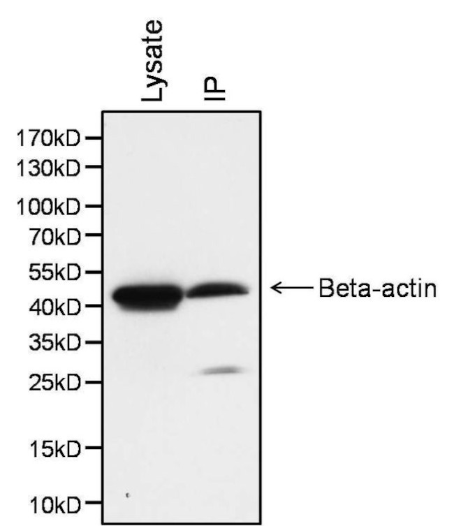 beta Actin Antibody in Immunoprecipitation (IP)