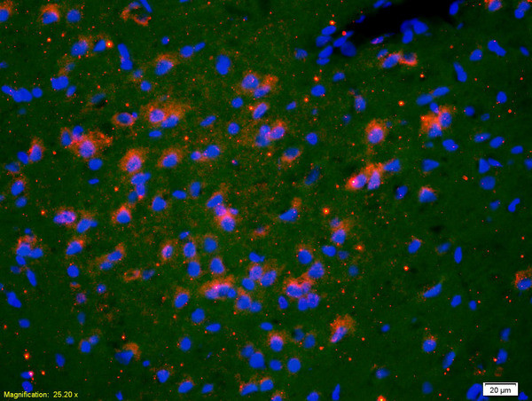 TSHR Antibody in Immunohistochemistry (Paraffin) (IHC (P))