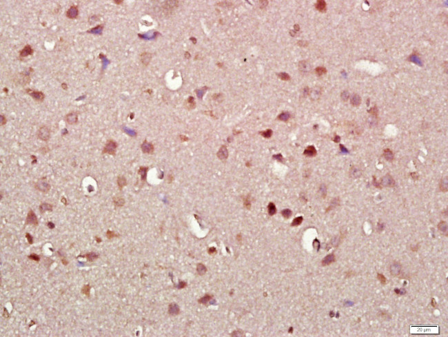 alpha Synuclein Antibody in Immunohistochemistry (Paraffin) (IHC (P))