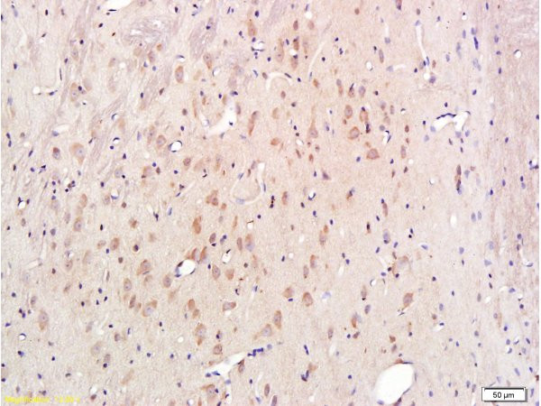 Cytochrome C Antibody in Immunohistochemistry (Paraffin) (IHC (P))