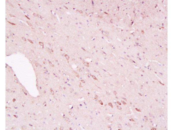 Tyrosine Hydroxylase Antibody in Immunohistochemistry (Paraffin) (IHC (P))