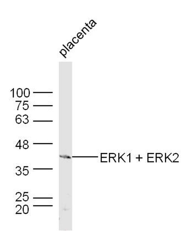 ERK1/ERK2 Polyclonal Antibody (BS-0022R)