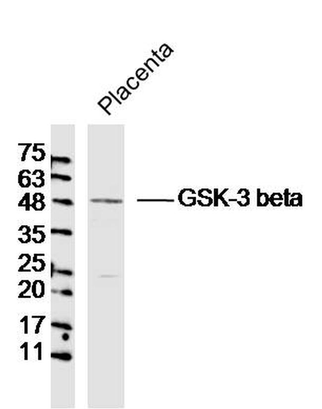 GSK3B Antibody in Western Blot (WB)