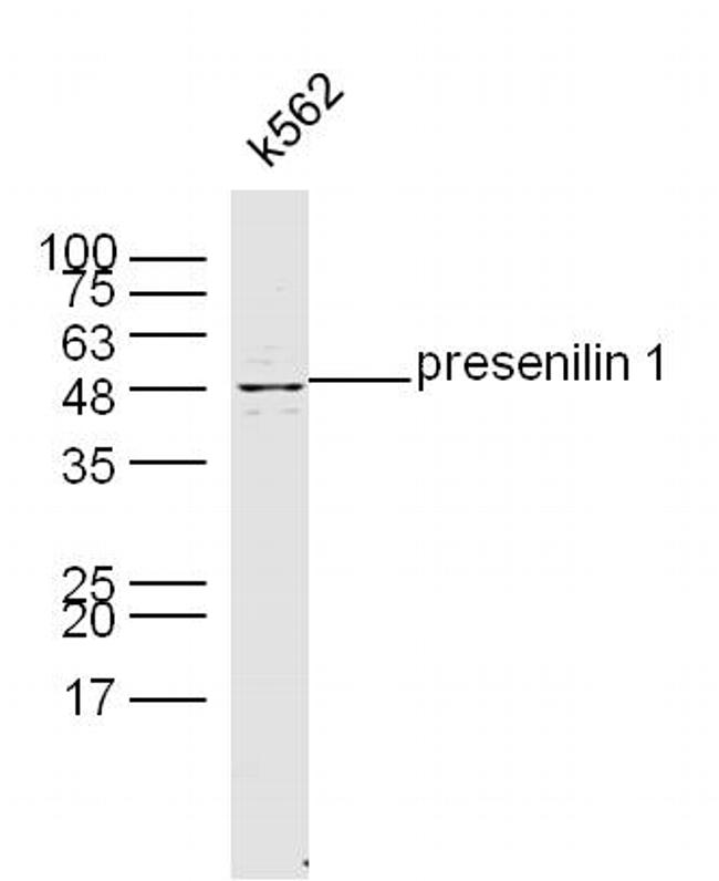 Presenilin 1 Polyclonal Antibody (BS0024R)