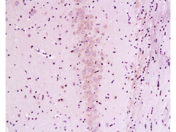 Calcineurin A Antibody in Immunohistochemistry (Paraffin) (IHC (P))