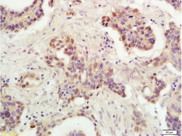 P53 proteinwt-p53 Antibody in Immunohistochemistry (Paraffin) (IHC (P))