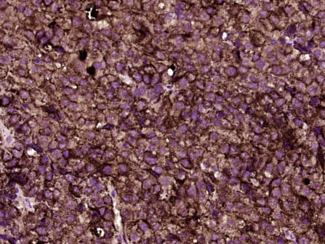 MLANA/MART1 Antibody in Immunohistochemistry (Paraffin) (IHC (P))