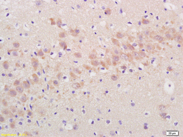 Artemin Antibody in Immunohistochemistry (Paraffin) (IHC (P))