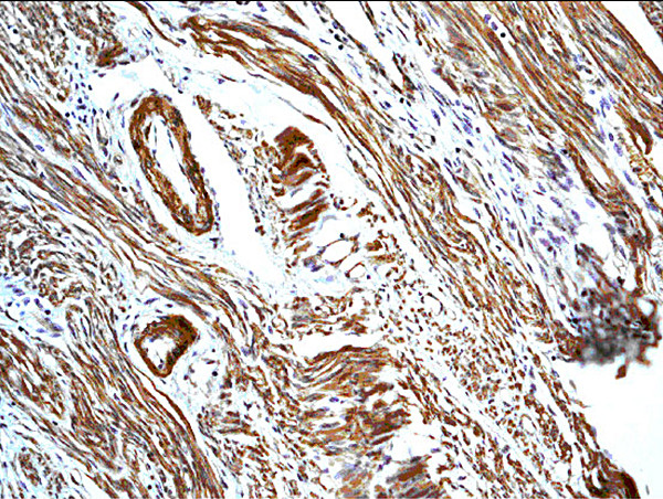 Calretinin Antibody in Immunohistochemistry (Paraffin) (IHC (P))