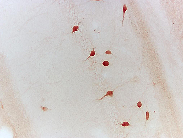 Neurturin Antibody in Immunohistochemistry (Paraffin) (IHC (P))