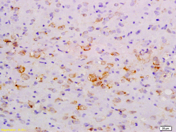 NFkB Inducing Kinase NIK Antibody in Immunohistochemistry (Paraffin) (IHC (P))