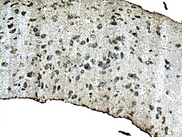 beta Amyloid 1-42 Antibody in Immunohistochemistry (Paraffin) (IHC (P))