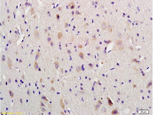 VIP Antibody in Immunohistochemistry (Paraffin) (IHC (P))