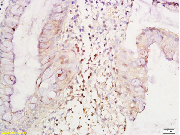 TNF alpha Antibody in Immunohistochemistry (Paraffin) (IHC (P))