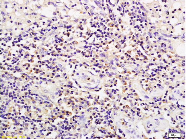 CD19 Antibody in Immunohistochemistry (Paraffin) (IHC (P))