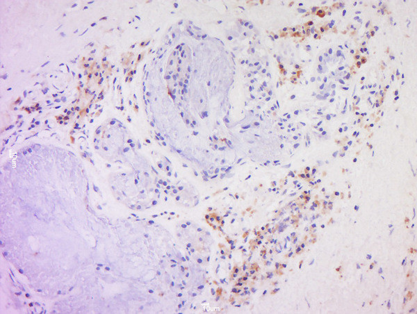 CD20 Antibody in Immunohistochemistry (Paraffin) (IHC (P))