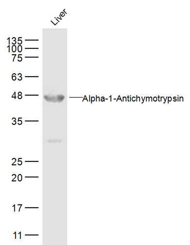 AACT Alpha1 Antibody in Western Blot (WB)