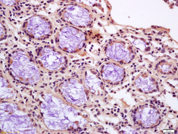 Calponin 1 Antibody in Immunohistochemistry (Paraffin) (IHC (P))