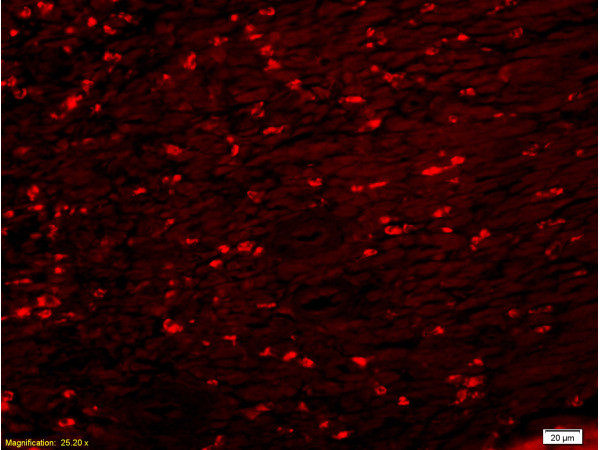 PKM2 Antibody in Immunohistochemistry (Paraffin) (IHC (P))