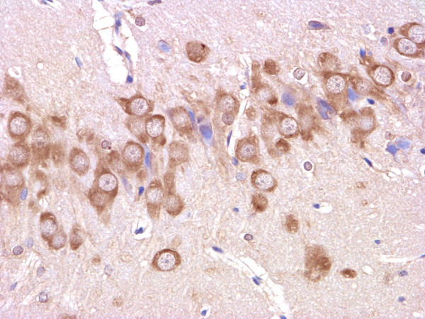beta Amyloid 1-42 Antibody in Immunohistochemistry (Paraffin) (IHC (P))